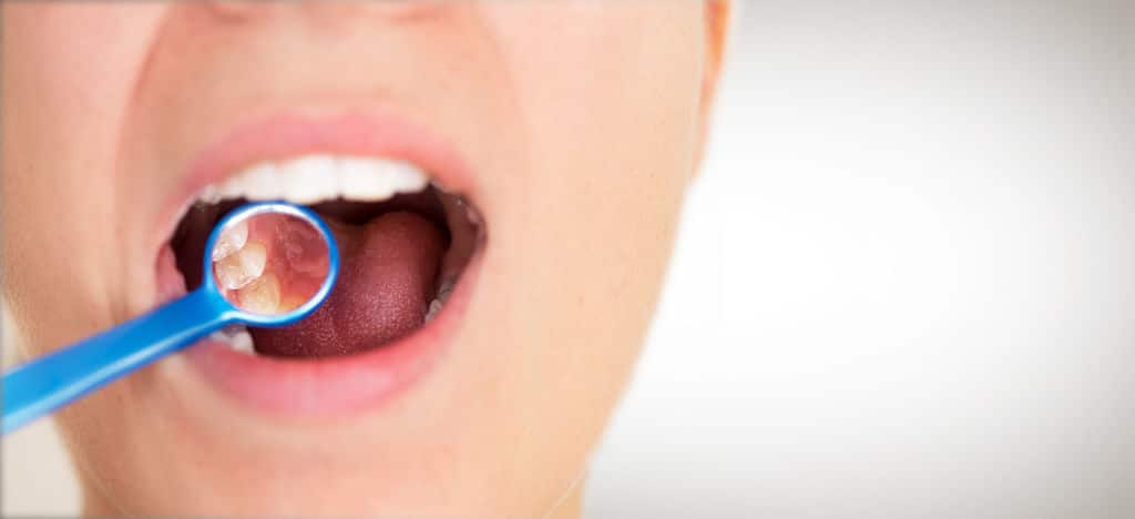 gum recession