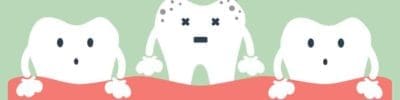 teeth extraction