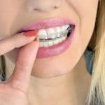 A person touching her braces