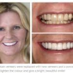 A blond-haired woman showing her teeth