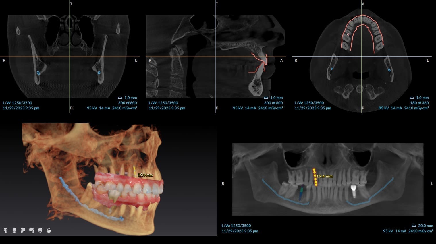 cbct example cbct example