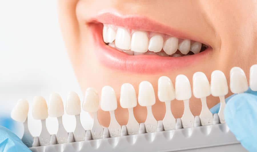 Perfect smile achieved using durable dental crowns at Valencia, CA clinic. Perfect smile achieved using durable dental crowns at Valencia, CA clinic.